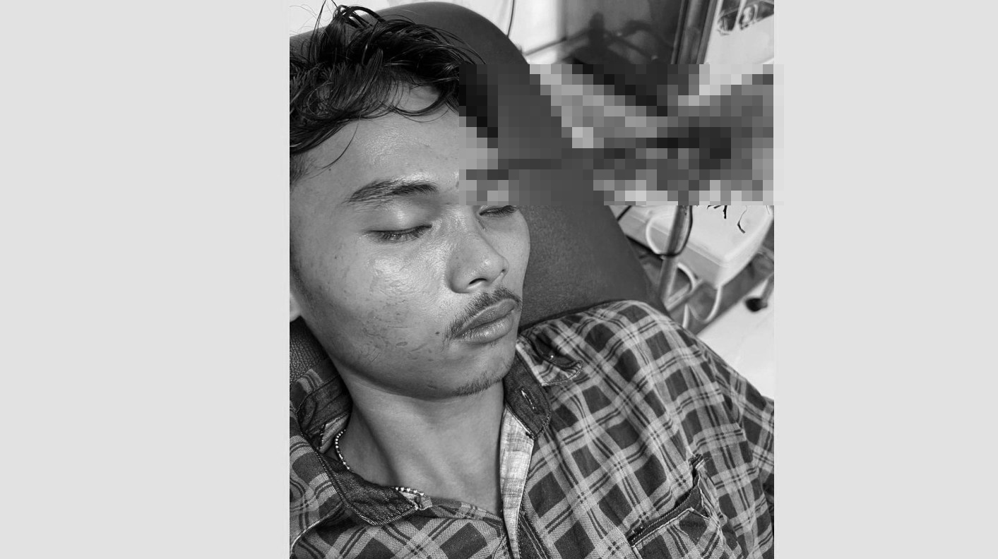 Korban Tawuran di Belawan Tidak Sadarkan Diri, Anak Panah Menancap di Kening