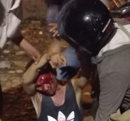 Akibat Jalan Rusak, Calon Pengantin Kritis Kecelakaan, Wajah Berdarah-darah