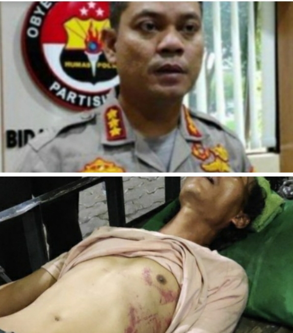 Diduga Aniaya Pak Ogah, Belasan "Baja" Diperiksa Propam : Poldasu Sampaikan Permintaan Maaf