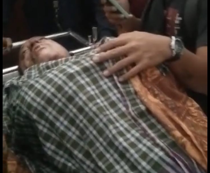 Deni, Korban Pembakaran Dua Pemuda Akhirnya Meninggal