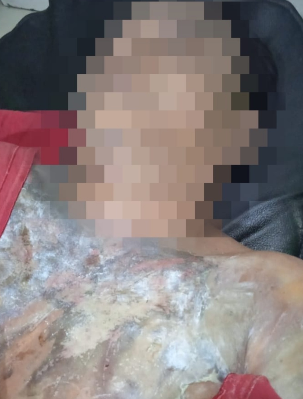Lagi Jalan-jalan dengan Teman Wanita, Buruh Bongkar Muat Tewas Disiram Air Keras