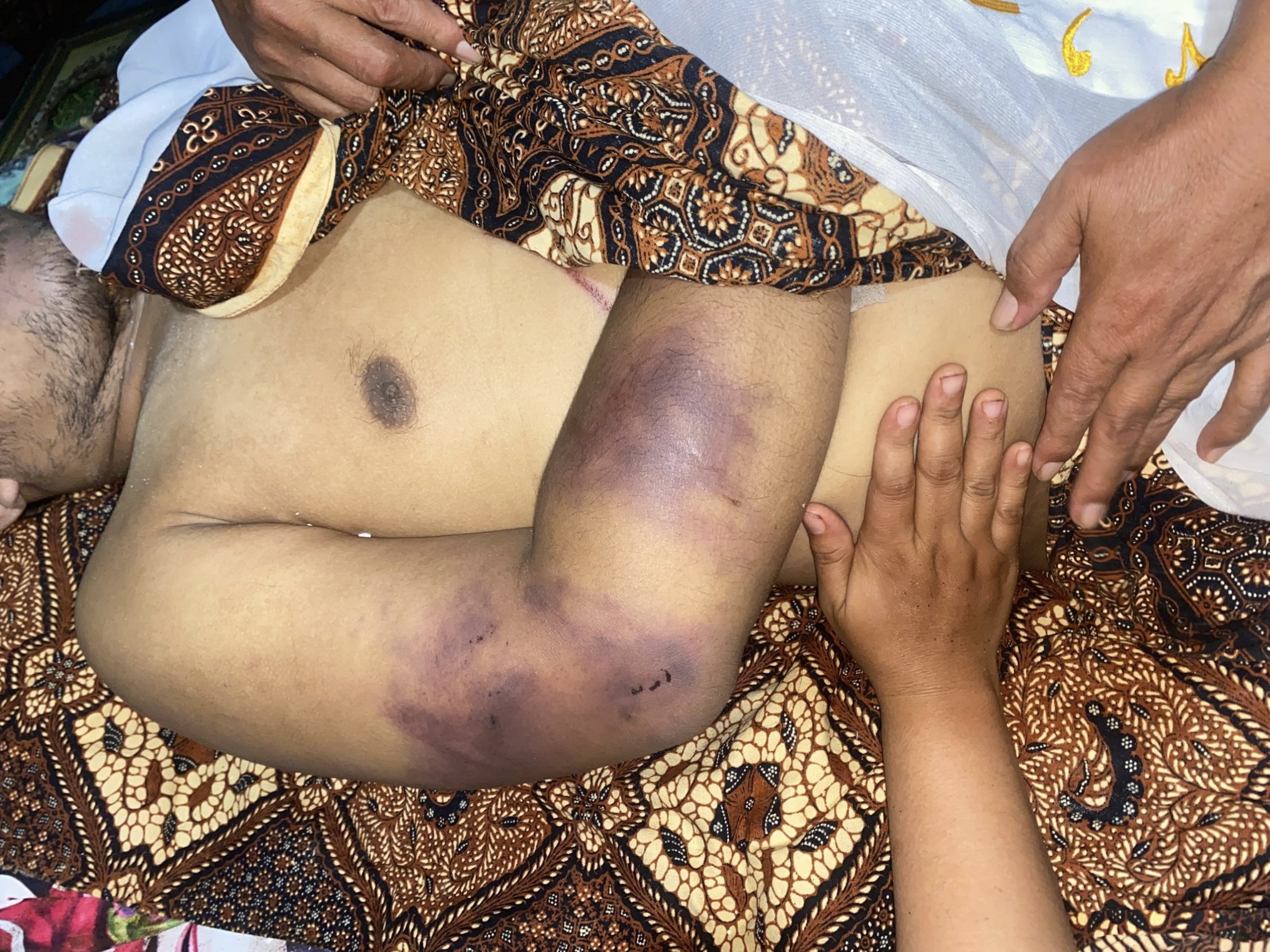 Dijemput dari Rumah Pagi-pagi Buta, Pria di Pancur Batu Tewas Mengenaskan