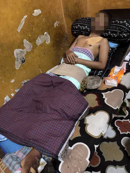 Niat Bantu Keponakan, Tambunan Malah Ditabrak Gerombolan Geng Motor : Korban Patah Tulang
