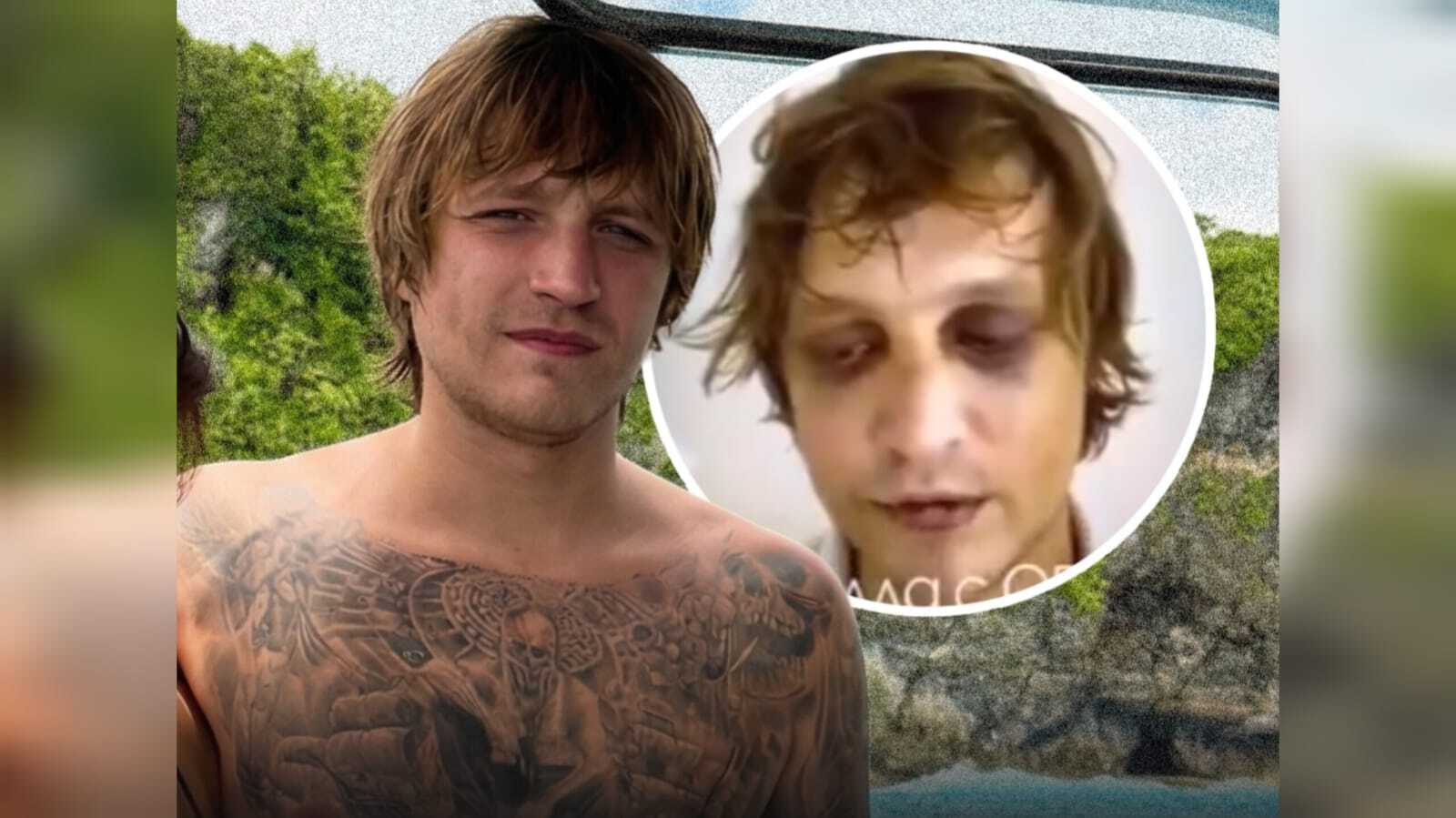 Mengejutkan ! Hasil DNA Mayat Terpotong di Bali Sama dengan WN Ukraina Hilang
