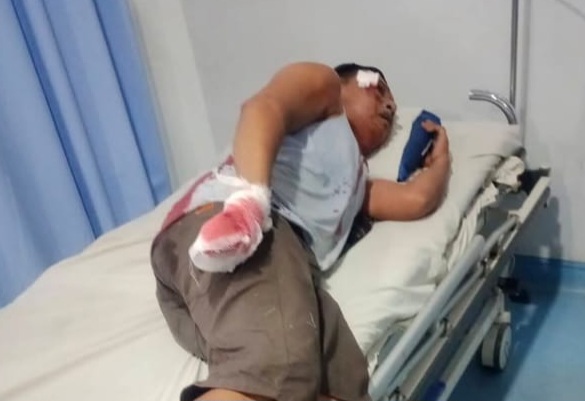 Penjaga Malam Dirampok dan Dibacok Geng Bermotor : Korban Berlumuran Darah