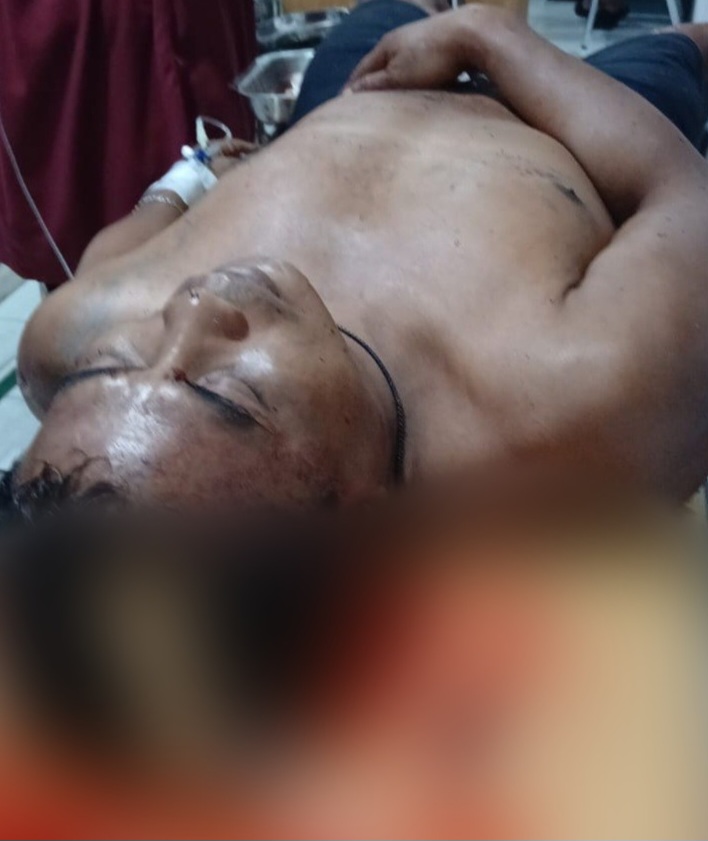 Rahmadsyah Diculik dan Dibacok Segerombolan Pemuda : Matikan ! Ini Perintah Ketua