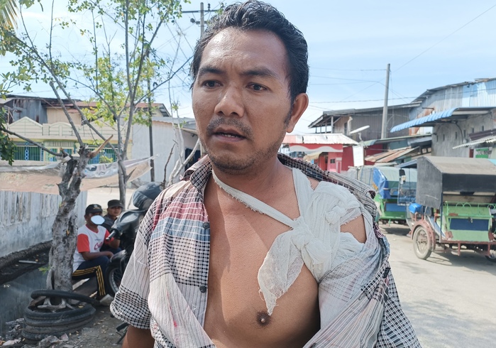 Ilyas, tukang becak yang kena begal di Jalan Kenanga menderita pergeseran bahu kiri usai dirampok.