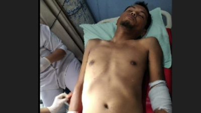 Herman Panjaitan, korban bentrok OKP IPK Vs PP di Sicanang, Belawan, Selasa (29/8/2023). Herman menderita luka bacok di lengan kiri.