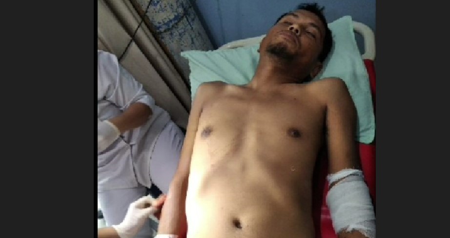 Herman Panjaitan, korban bentrok OKP IPK Vs PP di Sicanang, Belawan, Selasa (29/8/2023). Herman menderita luka bacok di lengan kiri.