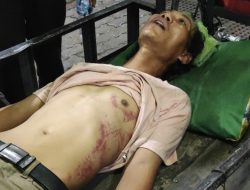 Pak Ogah di Kota Medan Ngaku Disiksa 15 Orang Polisi