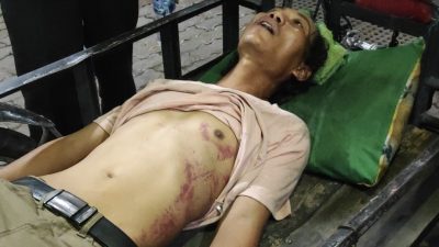 Pak Ogah di Kota Medan Ngaku Disiksa 15 Orang Polisi