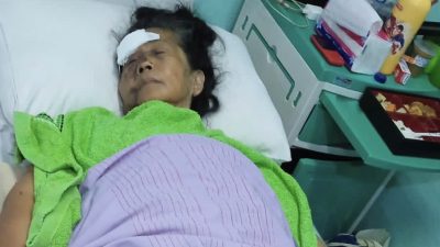 Tragis, Ibu dan Anak Luka-luka Jadi Korban Begal di Jalan Cemara