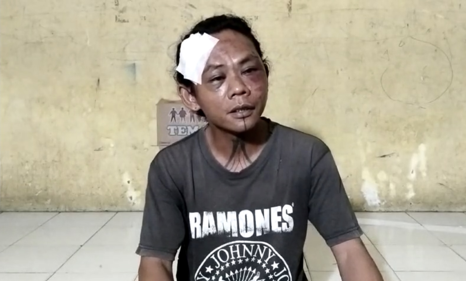 Jona Banjarnahor alias Ateng, petugas parkir di Komplek Mega Park dianiaya sekelompok pria cepak, Selasa (19/12/2023) malam. Korban mengalami luka lebam di wajah dan sekujur tubuh.(tajukrakyat.com)