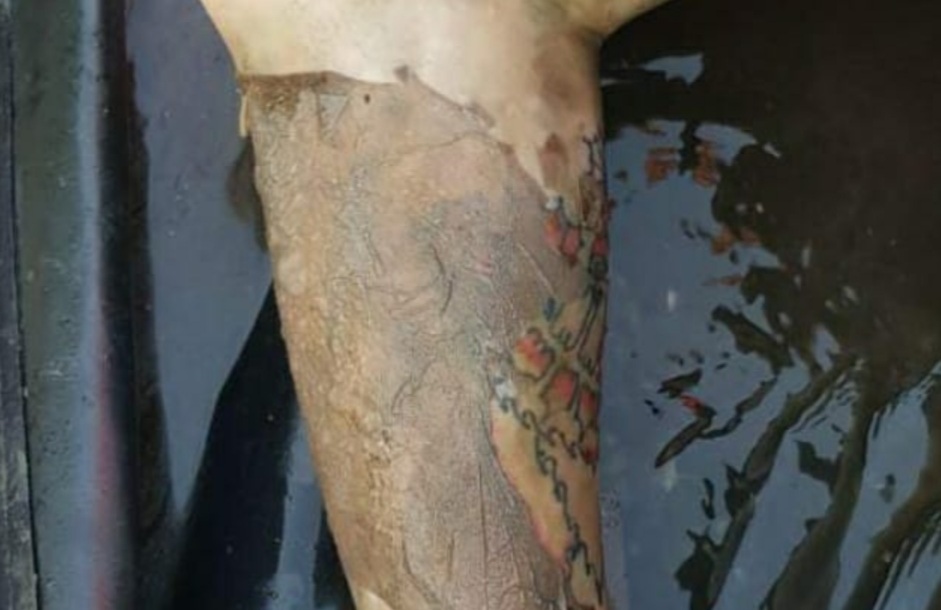 Ada tato di lengan kiri korban.(ist)