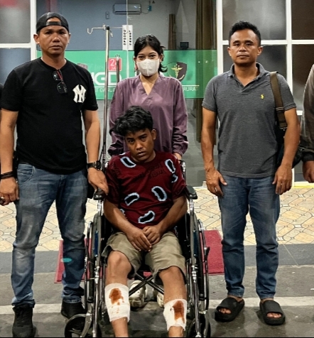 Kaki pelaku luka tembak. (ist)