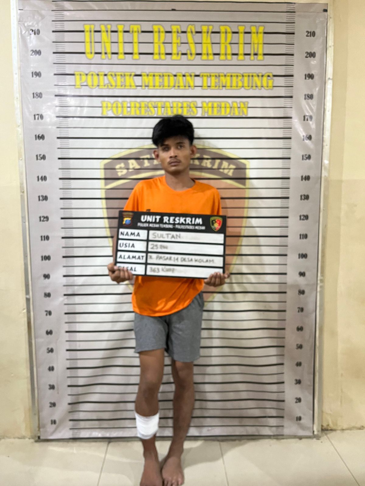 Sultan, maling yang kakinya ditembak penyidik Polsek Medan Tembung.