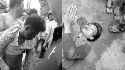 Dua pelaku jambret yang menewaskan korbannya saat diamuk massa di Kota Siantar. Satu diantaranya mengalami patah kaki.